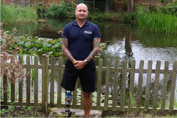Limbless veteran standing in front of a pond.