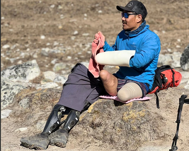 Double Amputee with prosthetic legs